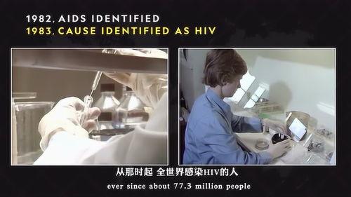 艾滋病的视频,病毒传播、症状与预防