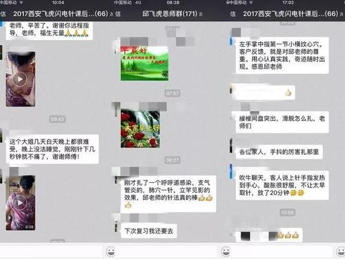 针灸视频教学,入门到精通的实用指南